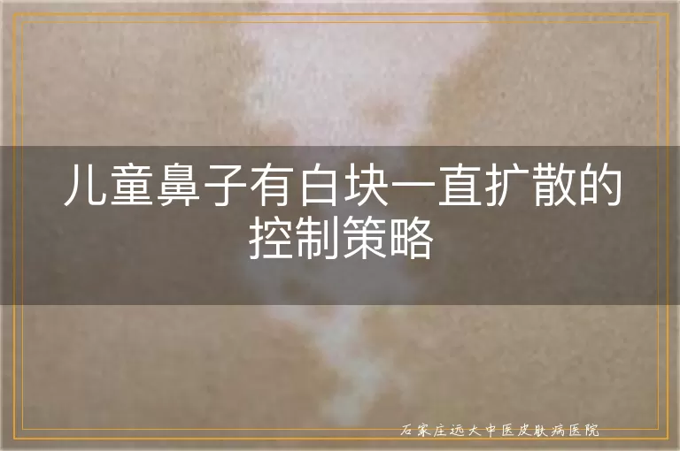 儿童鼻子有白块一直扩散的控制策略