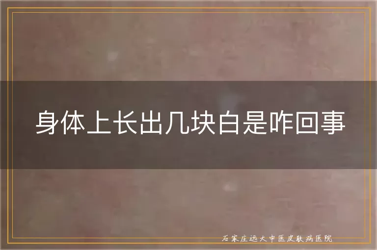 身体上长出几块白是咋回事