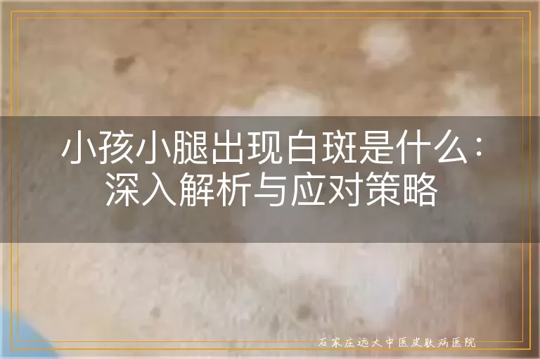 小孩小腿出现白斑是什么：深入解析与应对策略