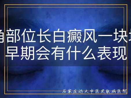 眼角部位长白癜风一块块的早期会有什么表现