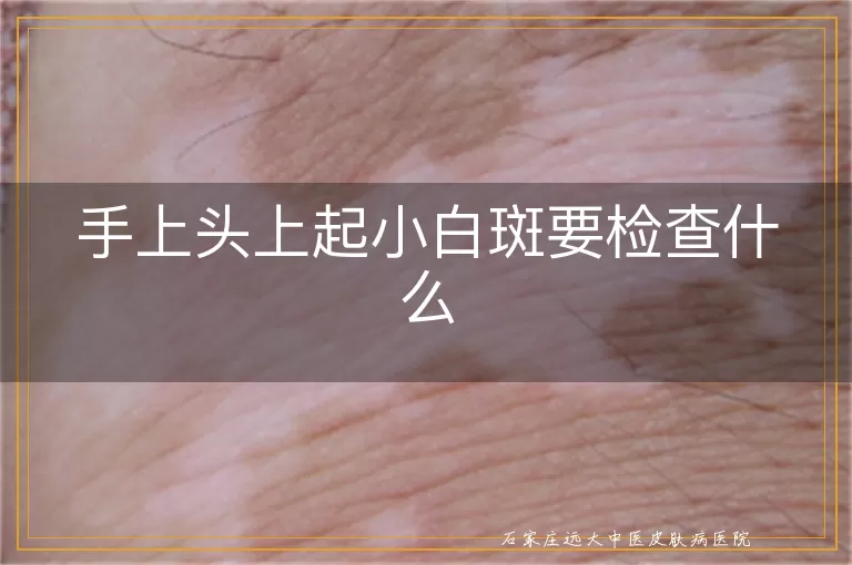 手上头上起小白斑要检查什么