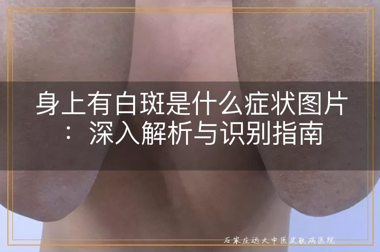 身上有白斑是什么症状图片：深入解析与识别指南