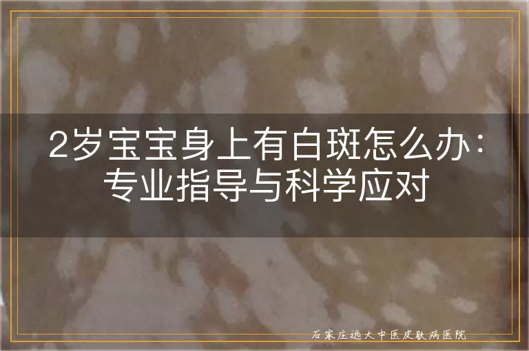 2岁宝宝身上有白斑怎么办：专业指导与科学应对