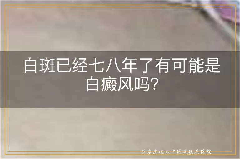 白斑已经七八年了有可能是白癜风吗？
