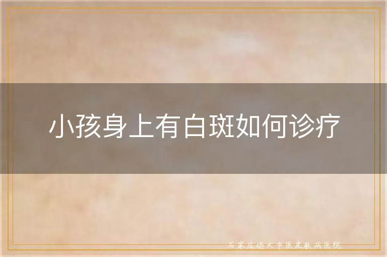 小孩身上有白斑如何诊疗