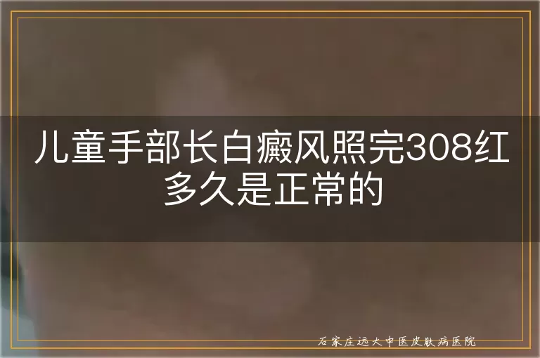 儿童手部长白癜风照完308红多久是正常的