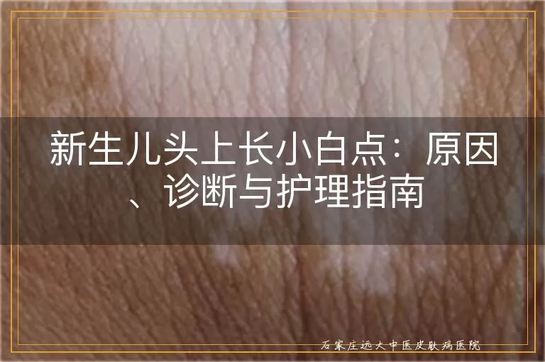 新生儿头上长小白点：原因、诊断与护理指南