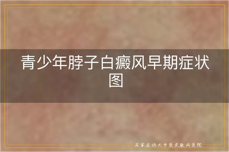 青少年脖子白癜风早期症状图
