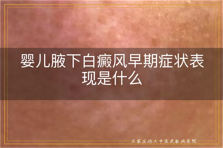 婴儿腋下白癜风早期症状表现是什么