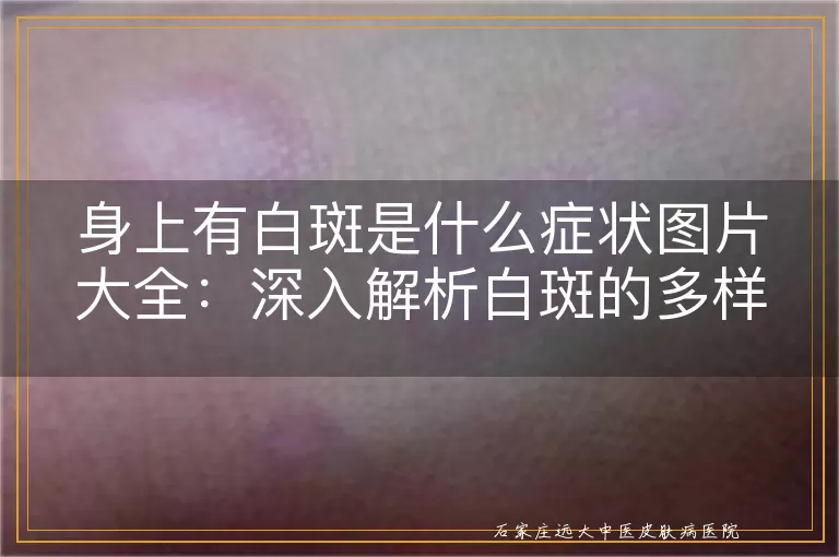 身上有白斑是什么症状图片大全：深入解析白斑的多样表现与可能原因