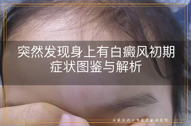 突然发现身上有白癜风初期症状图鉴与解析