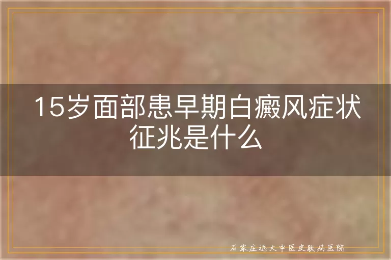 15岁面部患早期白癜风症状征兆是什么