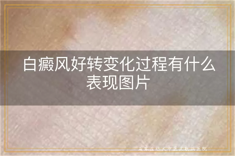白癜风好转变化过程有什么表现图片