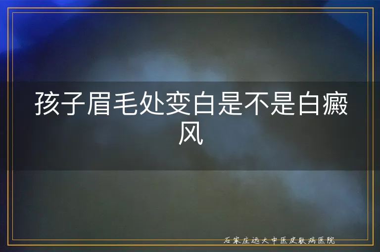 孩子眉毛处变白是不是白癜风