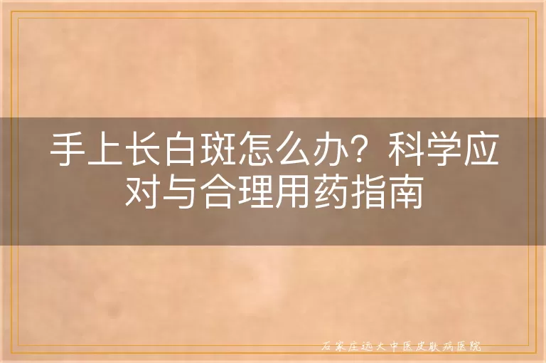 手上长白斑怎么办？科学应对与合理用药指南
