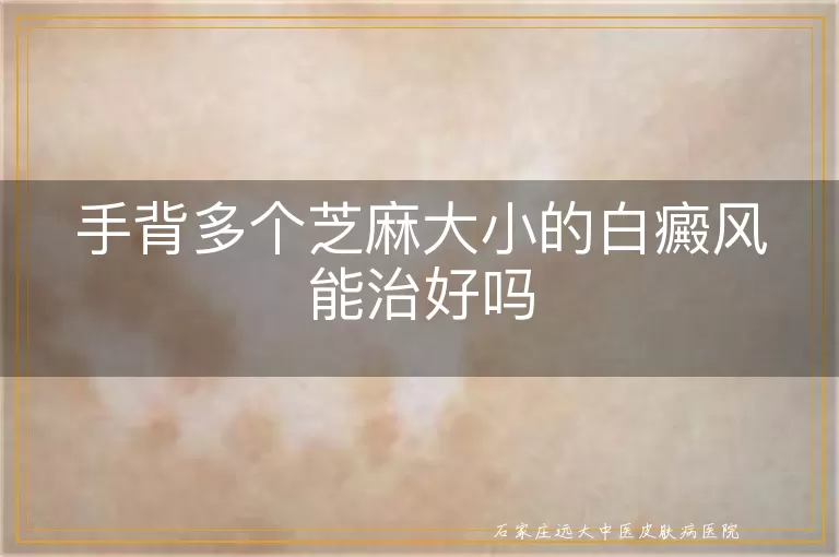 手背多个芝麻大小的白癜风能治好吗