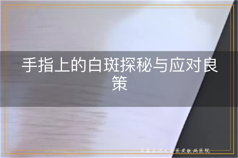 手指上的白斑探秘与应对良策