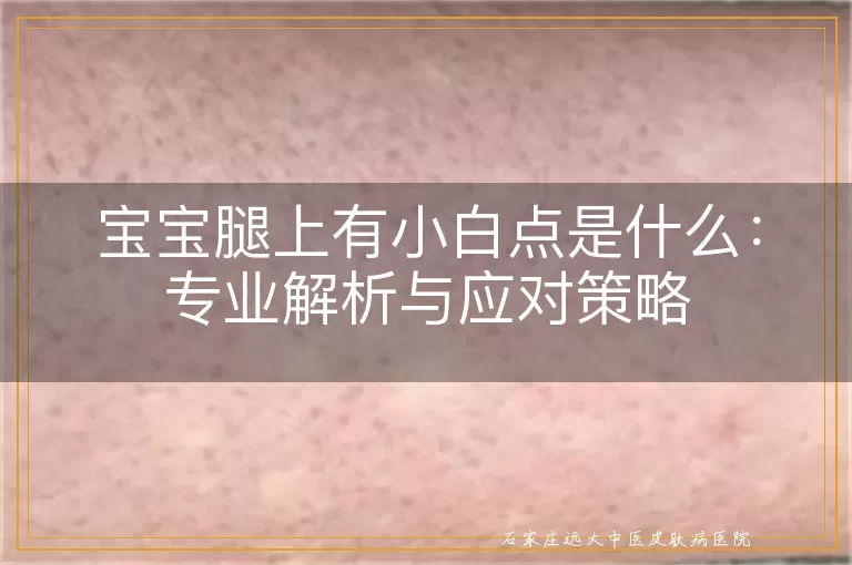 宝宝腿上有小白点是什么：专业解析与应对策略