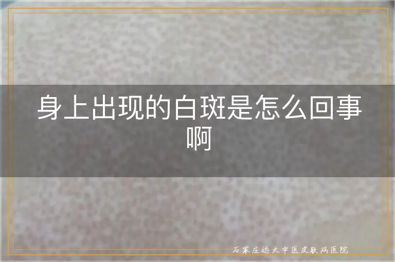 身上出现的白斑是怎么回事啊