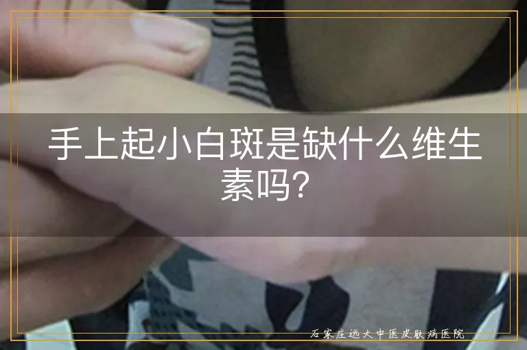 手上起小白斑是缺什么维生素吗？