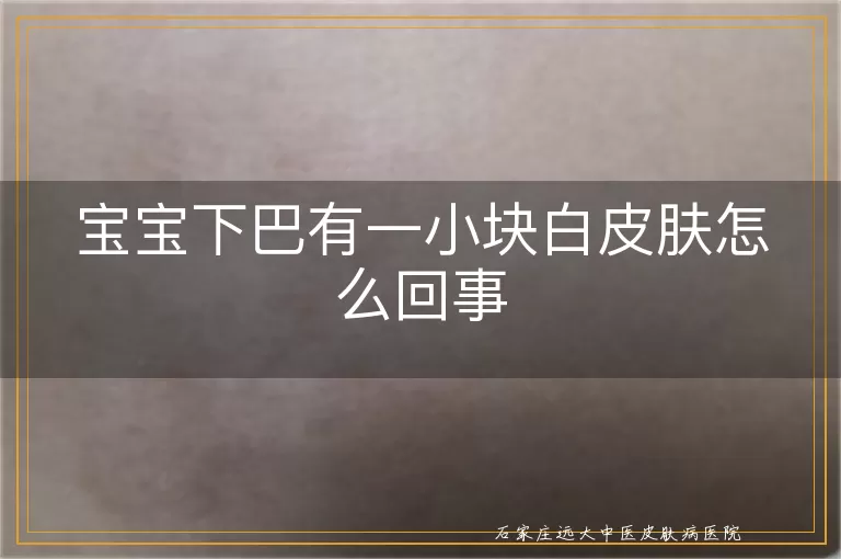 宝宝下巴有一小块白皮肤怎么回事