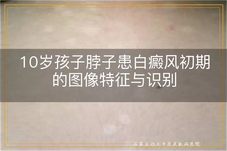10岁孩子脖子患白癜风初期的图像特征与识别
