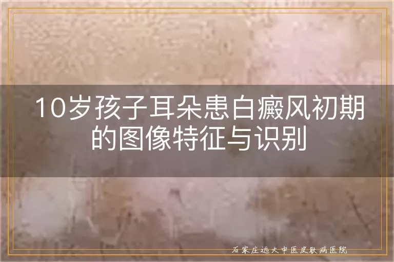 10岁孩子耳朵患白癜风初期的图像特征与识别