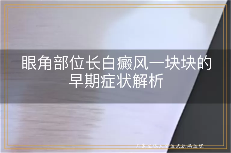 眼角部位长白癜风一块块的早期症状解析