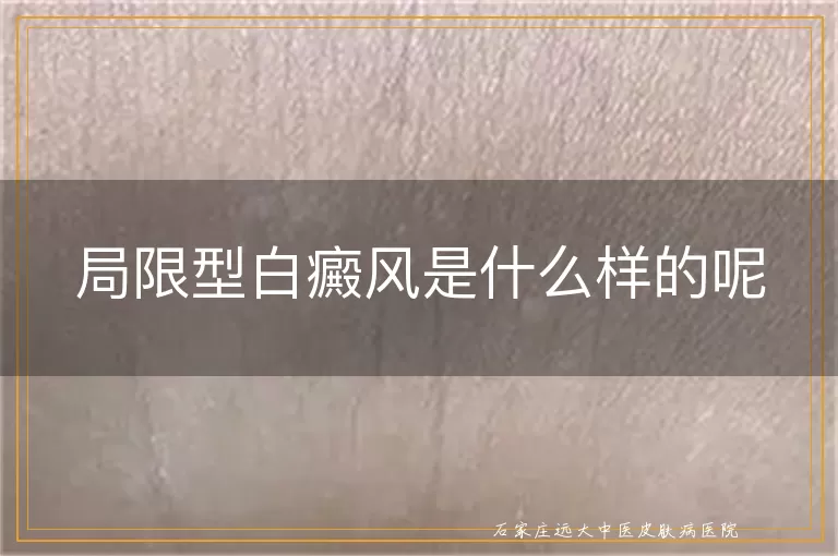 局限型白癜风是什么样的呢