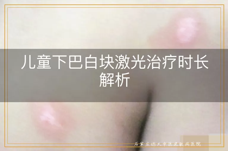 儿童下巴白块激光治疗时长解析
