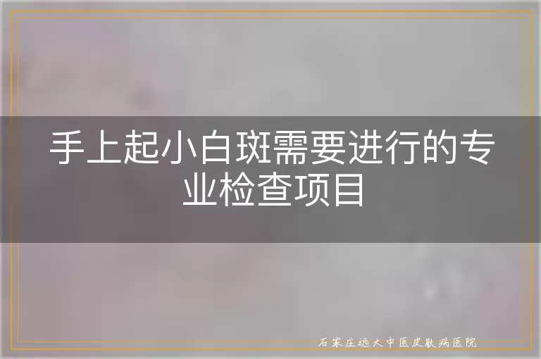 手上起小白斑需要进行的专业检查项目