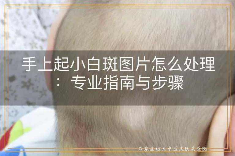 手上起小白斑图片怎么处理：专业指南与步骤
