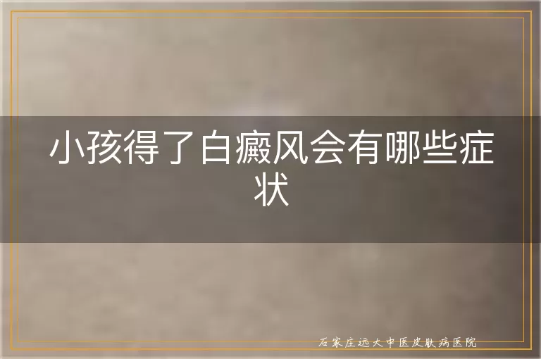 小孩得了白癜风会有哪些症状