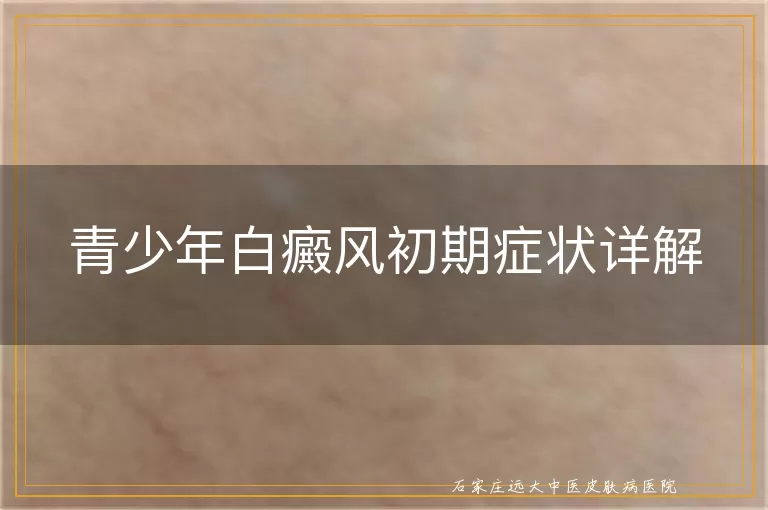 青少年白癜风初期症状详解