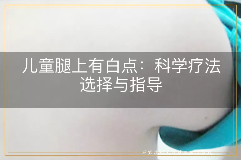 儿童腿上有白点：科学疗法选择与指导