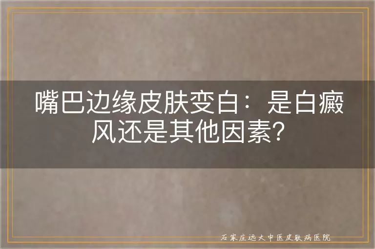 嘴巴边缘皮肤变白：是白癜风还是其他因素？