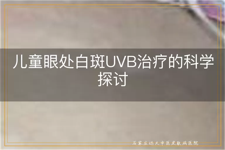 儿童眼处白斑UVB治疗的科学探讨