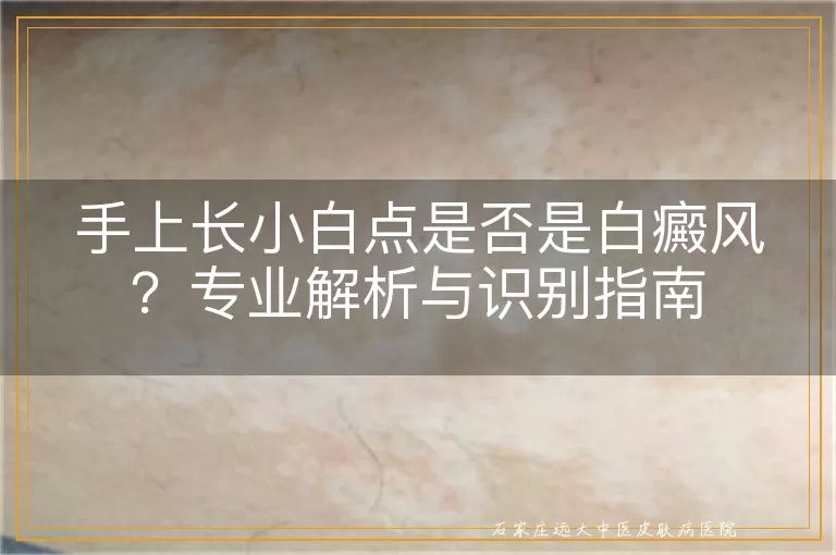 手上长小白点是否是白癜风？专业解析与识别指南