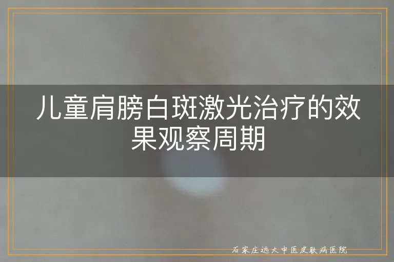 儿童肩膀白斑激光治疗的效果观察周期