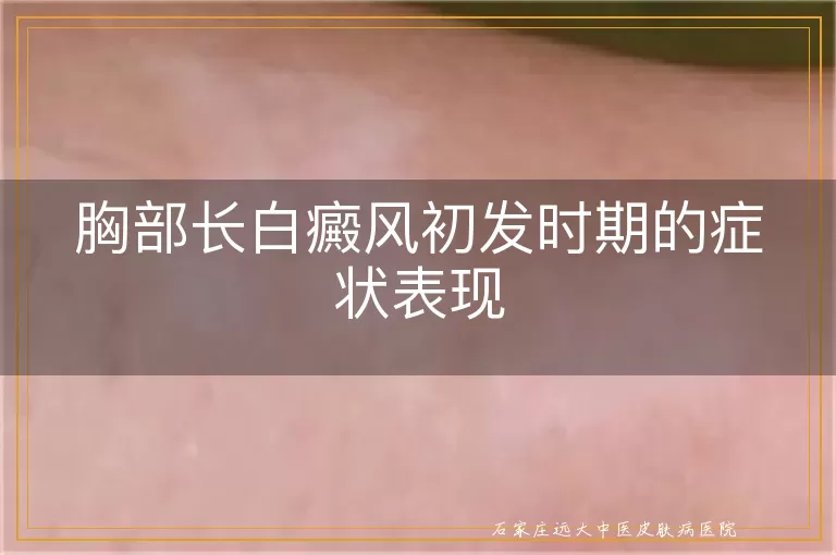 胸部长白癜风初发时期的症状表现