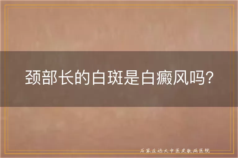 颈部长的白斑是白癜风吗？