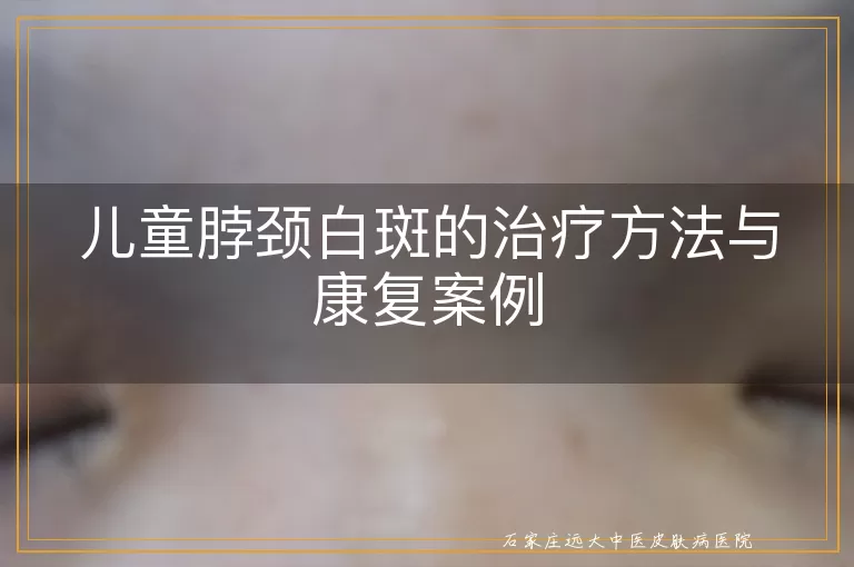 儿童脖颈白斑的治疗方法与康复案例