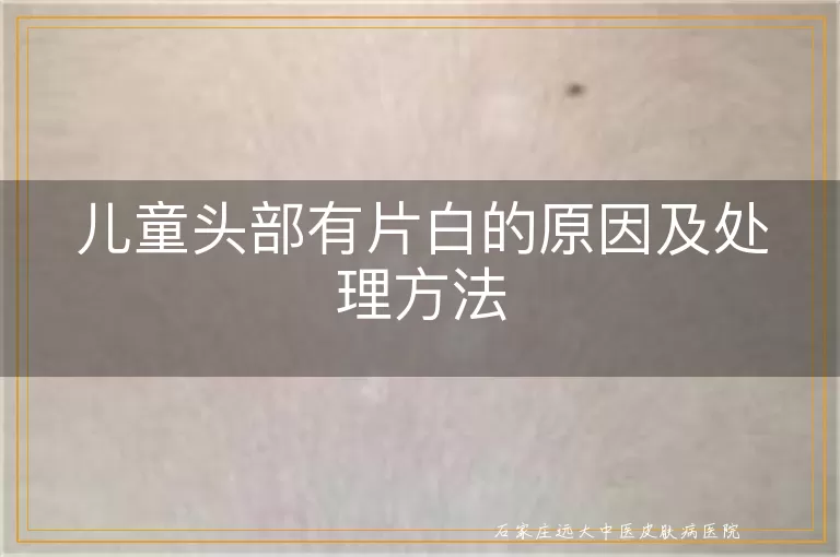 儿童头部有片白的原因及处理方法