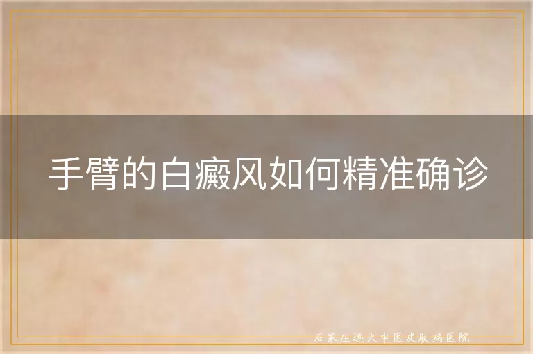 手臂的白癜风如何精准确诊