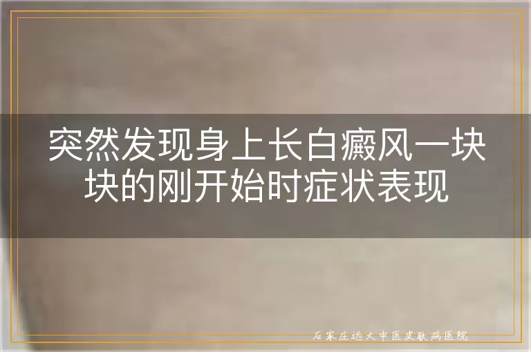 突然发现身上长白癜风一块块的刚开始时症状表现