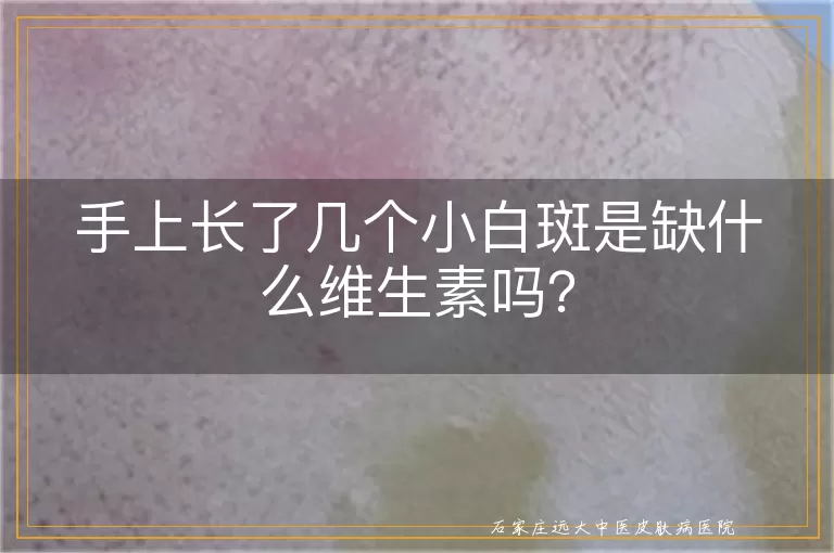 手上长了几个小白斑是缺什么维生素吗？