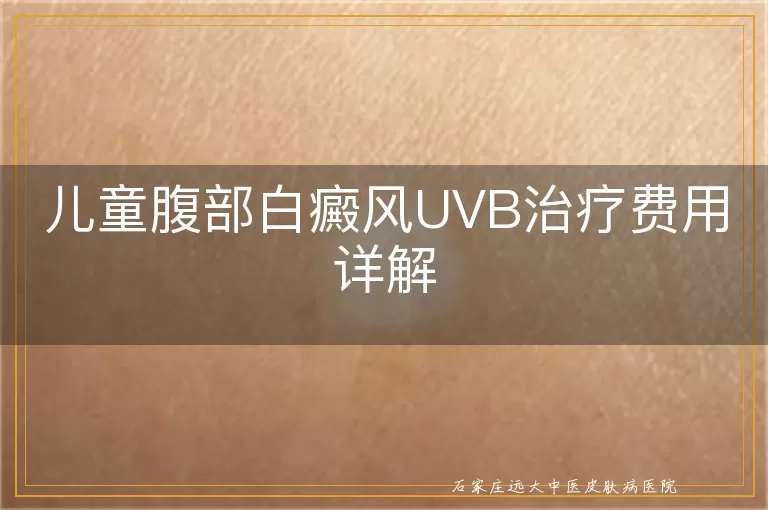 儿童腹部白癜风UVB治疗费用详解