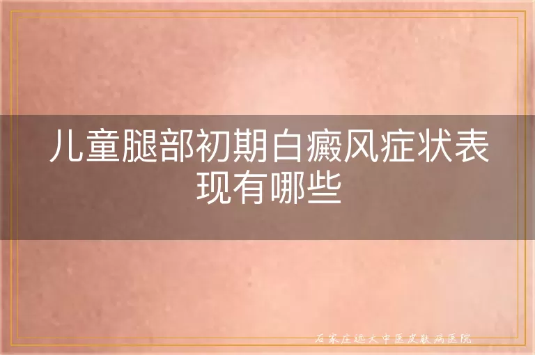 儿童腿部初期白癜风症状表现有哪些