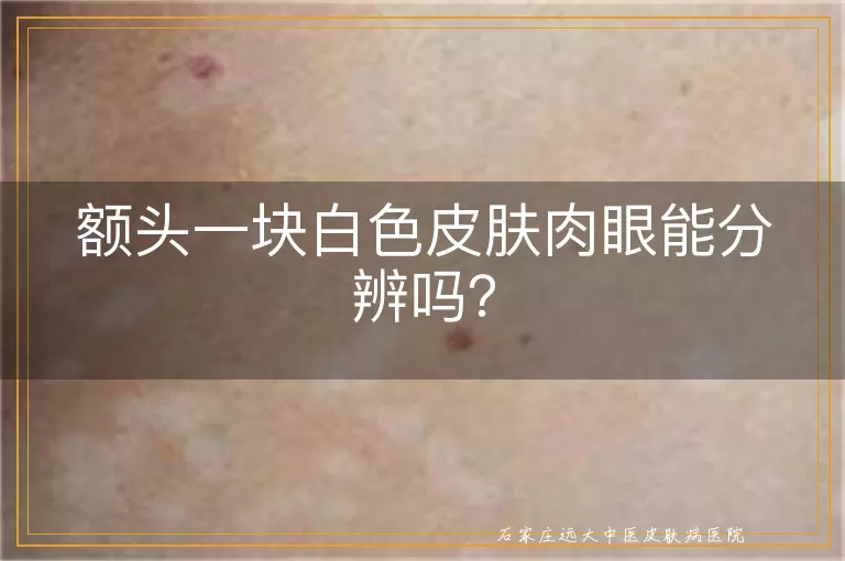 额头一块白色皮肤肉眼能分辨吗？