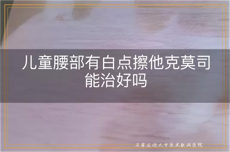 儿童腰部有白点擦他克莫司能治好吗